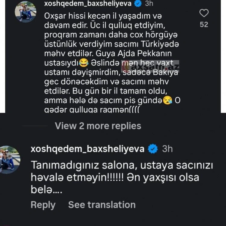 "Ajda Pekkanın stilisti saçlarımı məhv etdi" - (Foto)