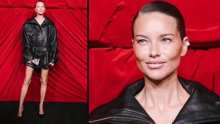 Adriana anoreksiyadan əziyyət çəkir?