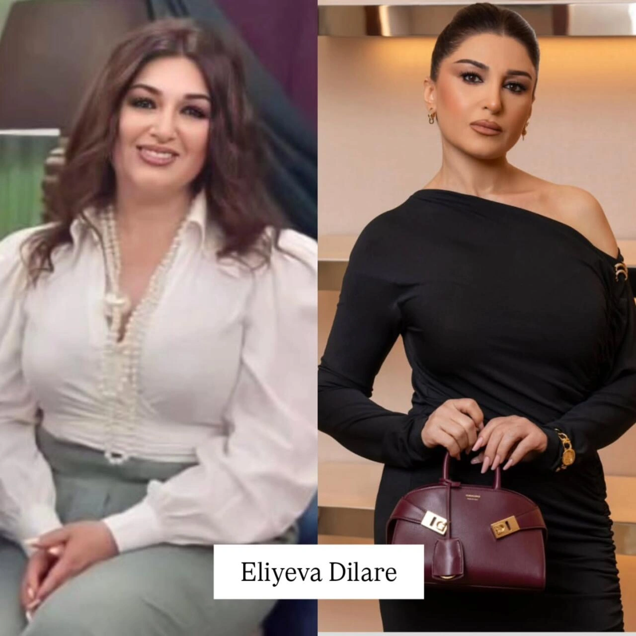 Arıqlayaraq tanınmaz dərəcədə dəyişən məşhurlarımız – Kimə daha çox yaraşıb? - (Fotolar)
