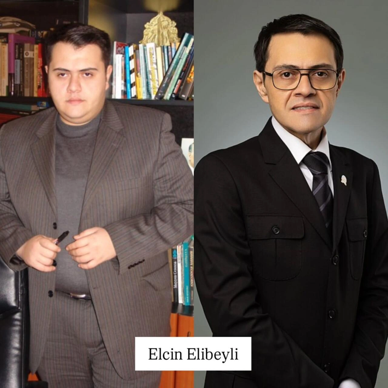 Arıqlayaraq tanınmaz dərəcədə dəyişən məşhurlarımız – Kimə daha çox yaraşıb? - (Fotolar)
