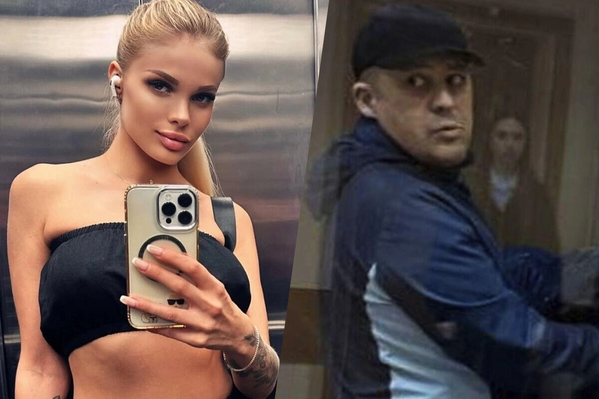Rus model sevgilisi tərəfindən vəhşicəsinə döyüldü – Kəllə sümüyünün yarısını itirib - (Fotolar)