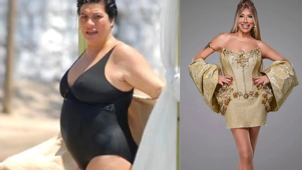 Məşhur türkiyəli müğənni 72 kilo arıqlayıb tanınmaz hala düşdü - VİDEO