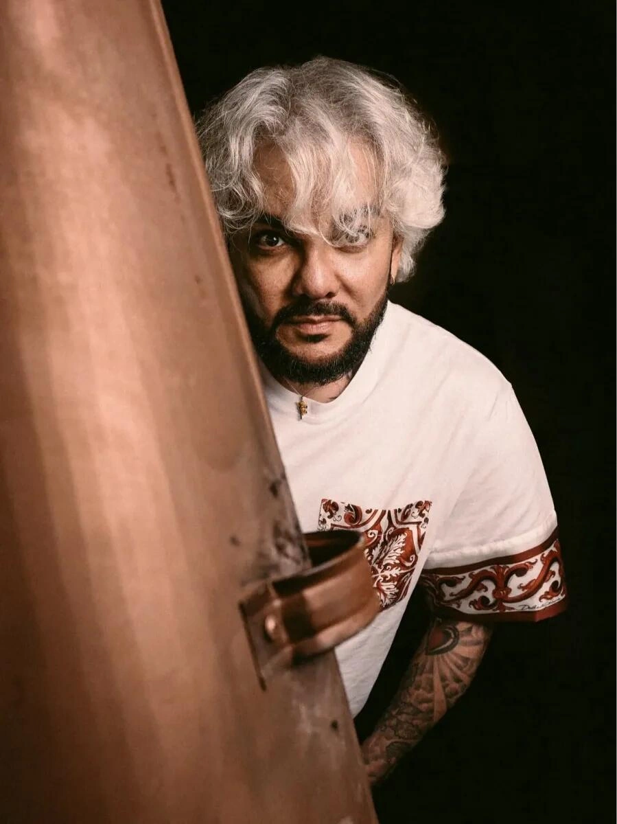 Kirkorov əməliyyatdan sonra (Foto)