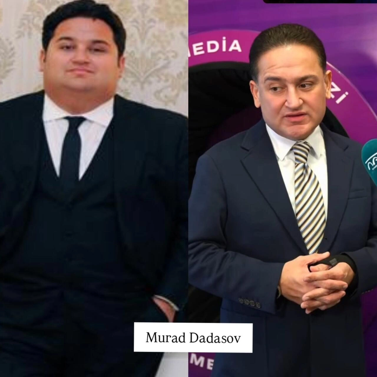 Arıqlayaraq tanınmaz dərəcədə dəyişən məşhurlarımız – Kimə daha çox yaraşıb? - (Fotolar)
