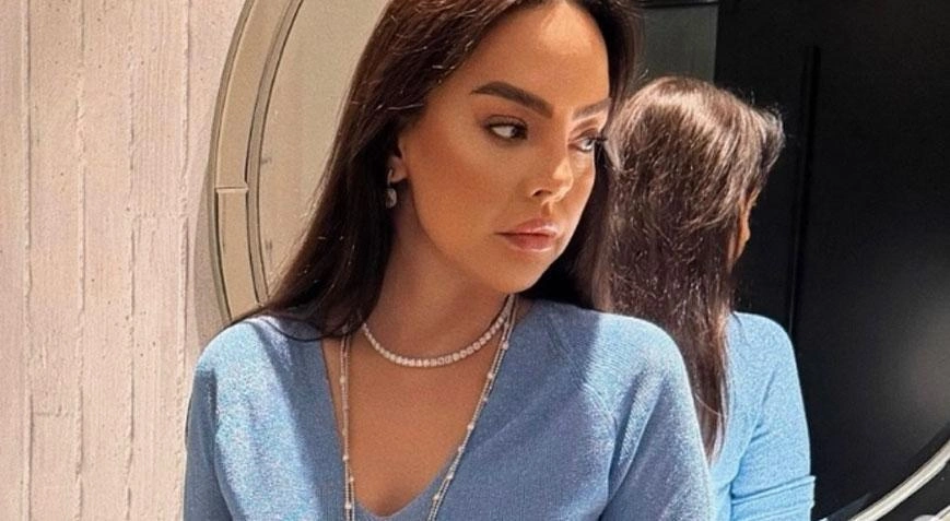 Üz gərmə əməliyyatından sonra Ebru Gündeş belə oldu - (Foto)