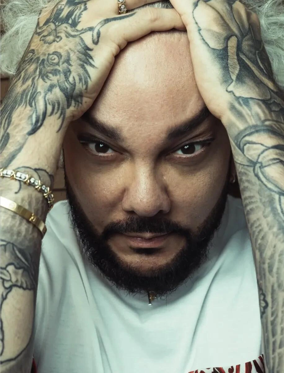 Kirkorov əməliyyatdan sonra (Foto)