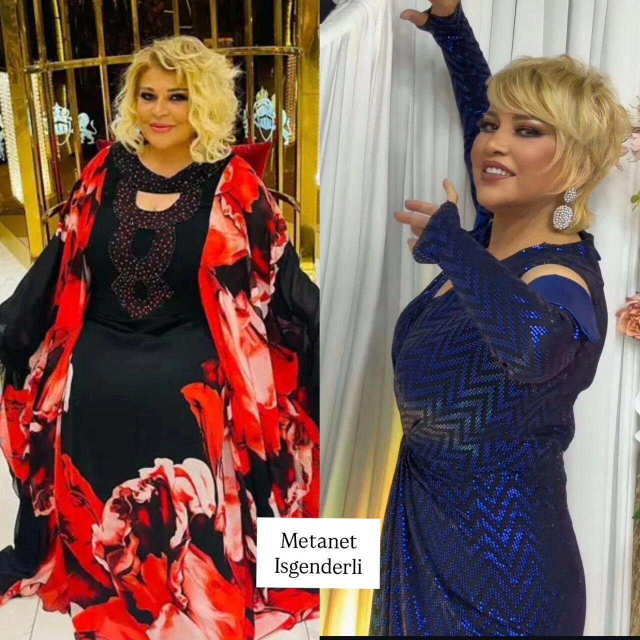 Arıqlayaraq tanınmaz dərəcədə dəyişən məşhurlarımız – Kimə daha çox yaraşıb? - (Fotolar)