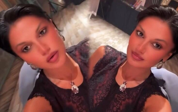 Natavan Həbibi görünüşünü dəyişdirdi - (Foto)