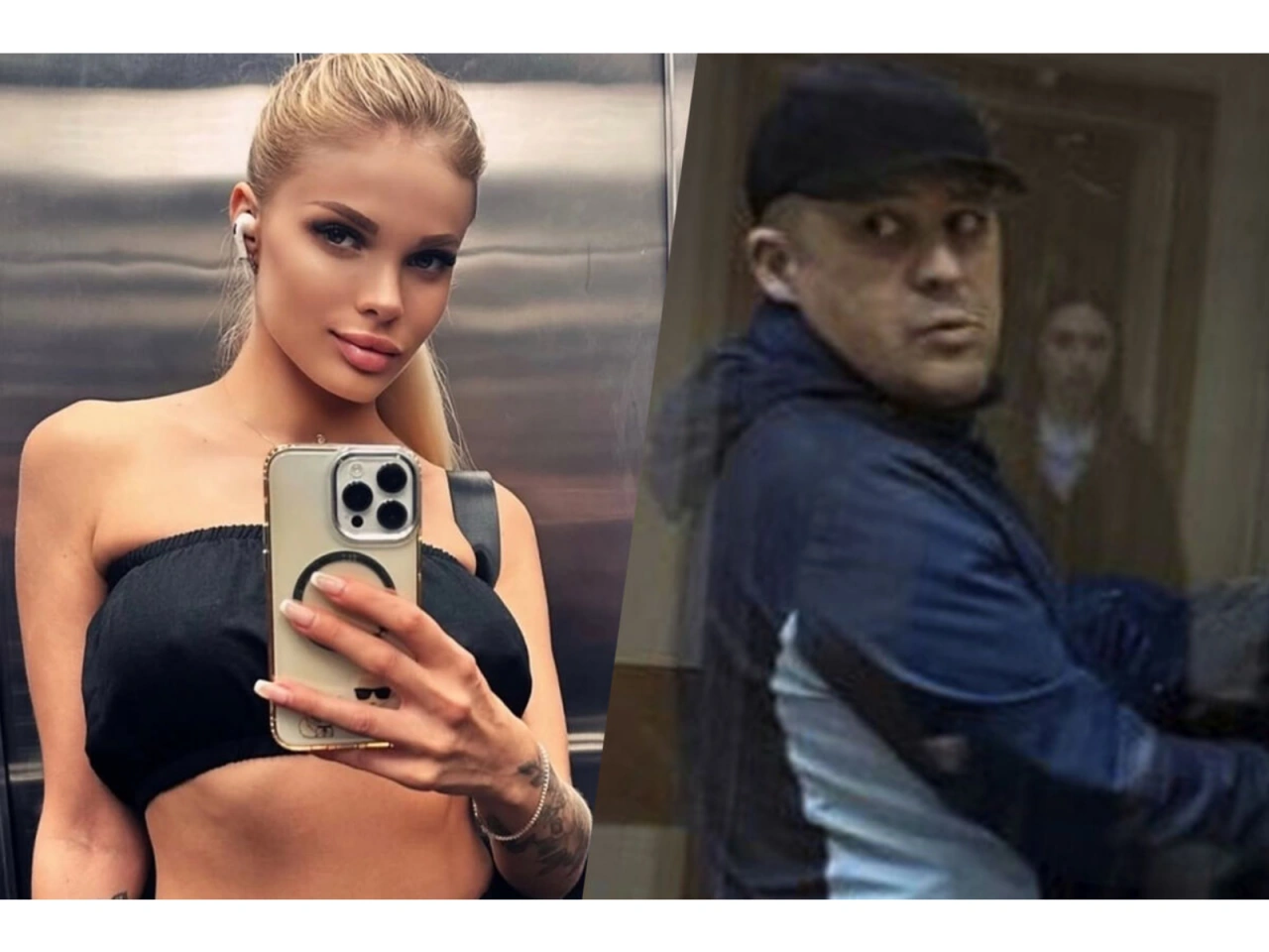 Rus model sevgilisi tərəfindən vəhşicəsinə döyüldü – Kəllə sümüyünün yarısını itirib - (Fotolar)