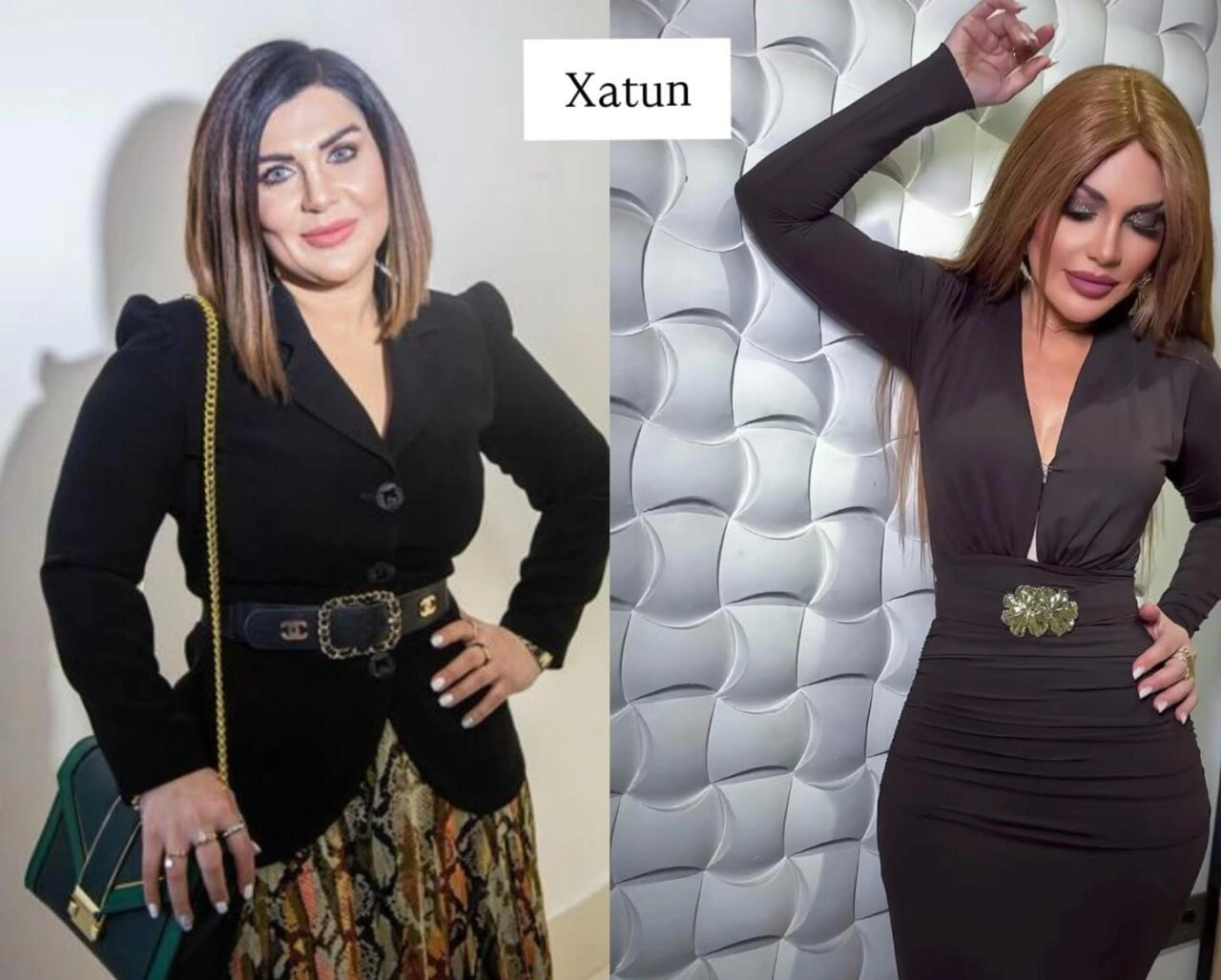 Arıqlayaraq tanınmaz dərəcədə dəyişən məşhurlarımız – Kimə daha çox yaraşıb? - (Fotolar)